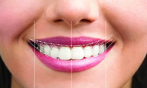 Dental-smile-design Dental-smile-design